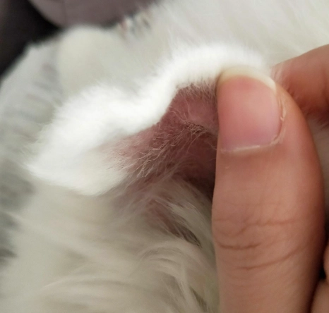 耳血腫手術費用 耳血腫手術費用