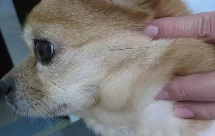胸腔腫瘤症狀 胸腔腫瘤症狀