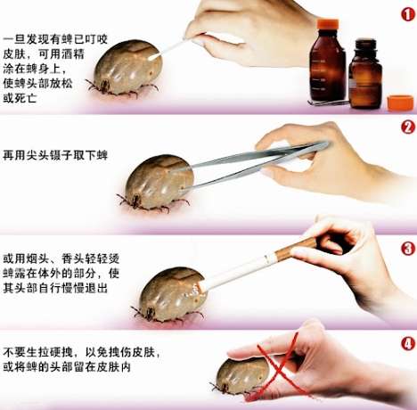 牛蜱移除技巧 牛蜱移除技巧