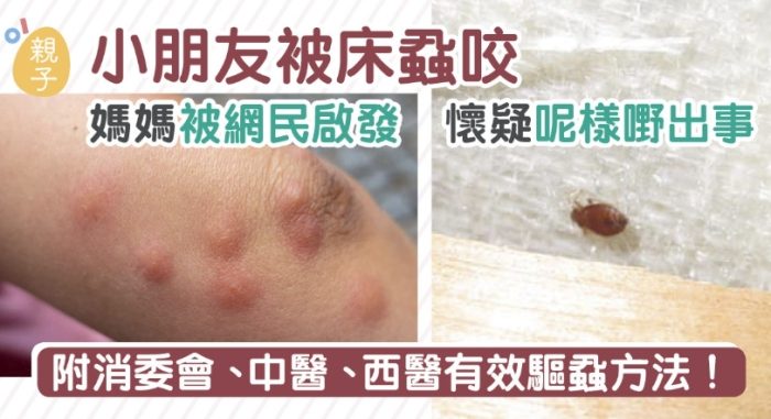 壁蝨叮咬處理 壁蝨叮咬處理