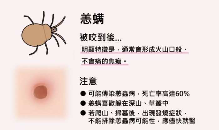 壁蝨叮咬處理 壁蝨叮咬處理