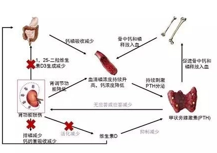 鈣磷失衡症狀 鈣磷失衡症狀