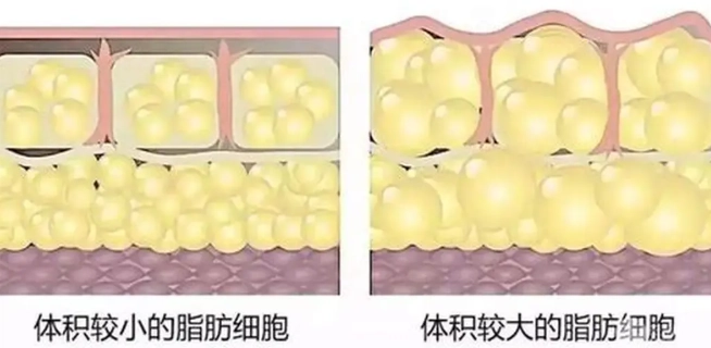 良性腫瘤護理 良性腫瘤護理